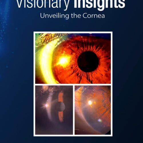 Visionary Insights: Unveiling the Cornea