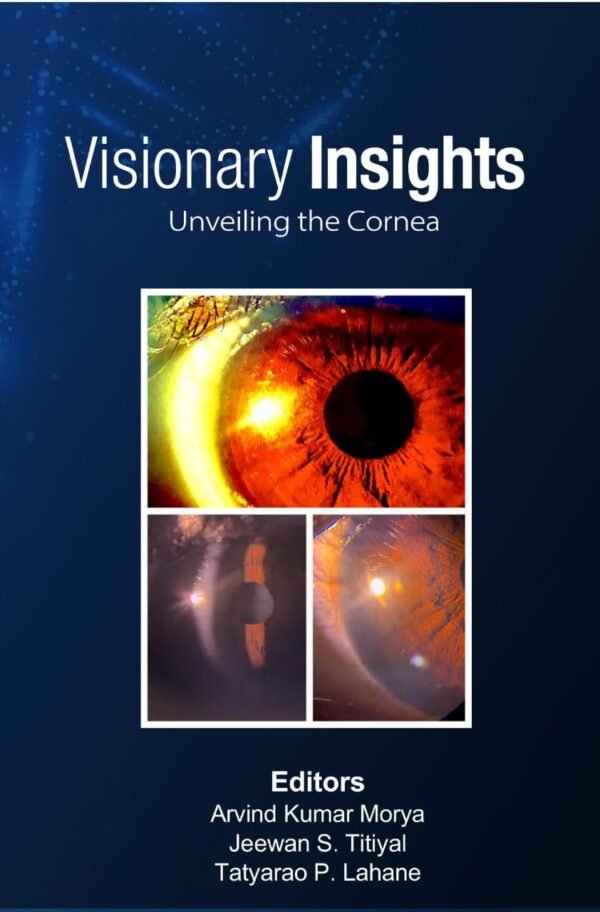 Visionary Insights: Unveiling the Cornea